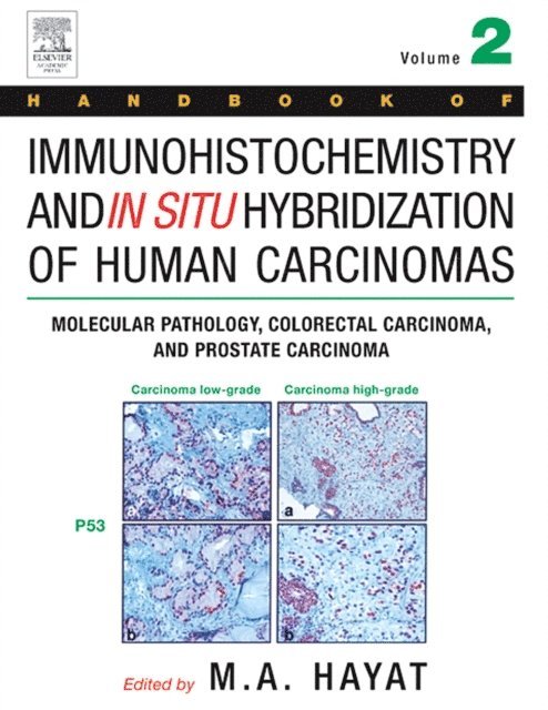 M. A. Hayat - Handbook of Immunohistochemistry and in Situ Hybridization of Human Carcinomas, E-bok