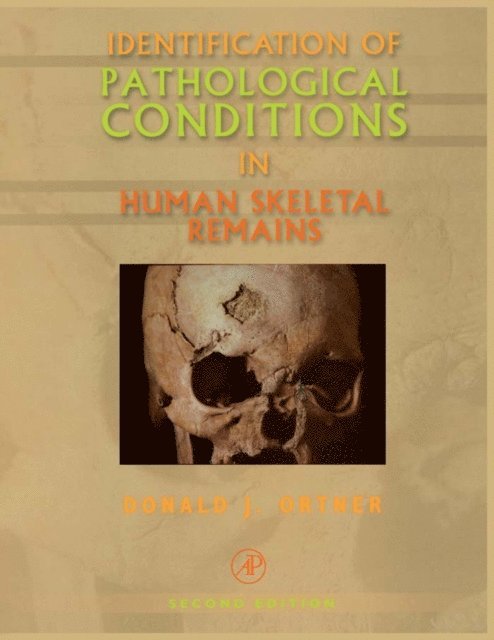 Donald J. Ortner - Identification of Pathological Conditions in Human Skeletal Remains, E-bok