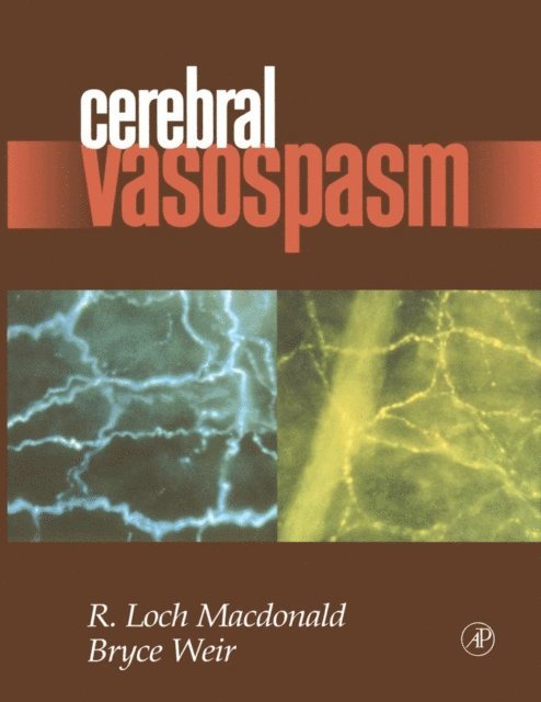 Bruce Weir, R. Loch Macdonald - Cerebral Vasospasm, E-bok