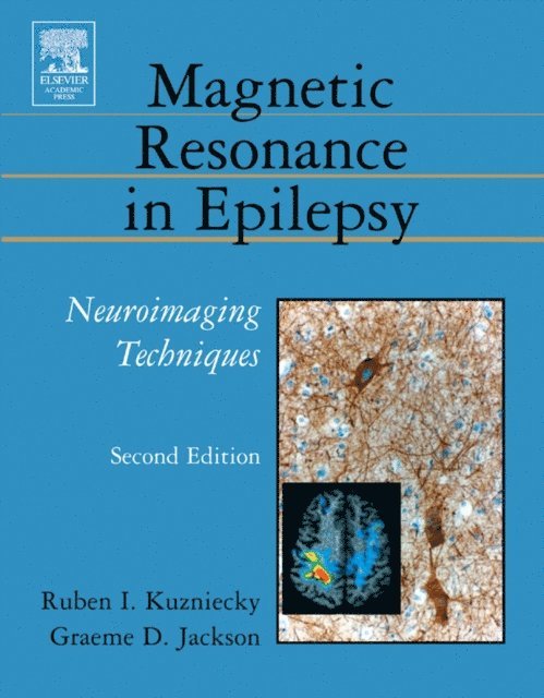 Graeme D. Jackson, Ruben Kuzniecky - Magnetic Resonance in Epilepsy, E-bok. Tillgänglighet: Lägg i varukorg