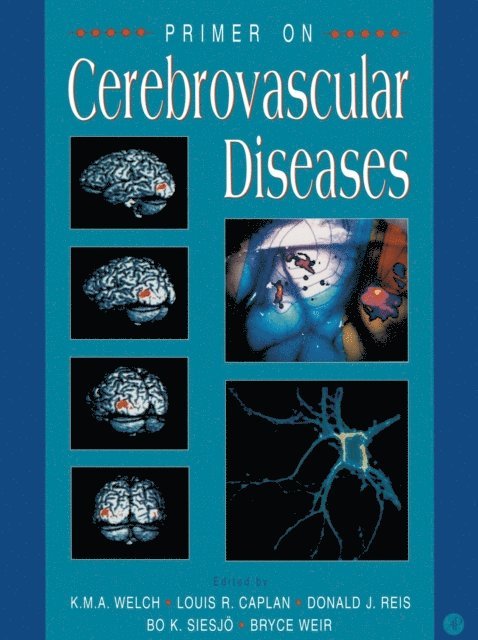 Donald J. Reis, K. Michael Welch, Bruce Weir, Bo K. Siesjo, Louis R. Caplan - Primer on Cerebrovascular Diseases, E-bok
