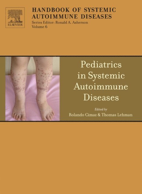 Thomas J.A. Lehman, Rolando Cimaz - Pediatrics in Systemic Autoimmune Diseases, E-bok