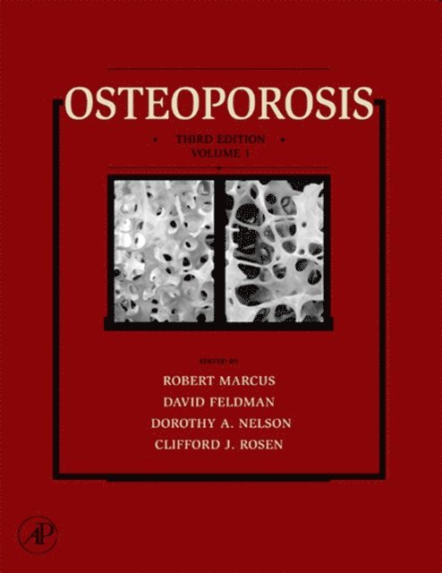 Clifford Rosen, Dorothy Nelson, David Feldman, Robert Marcus - Osteoporosis, E-bok