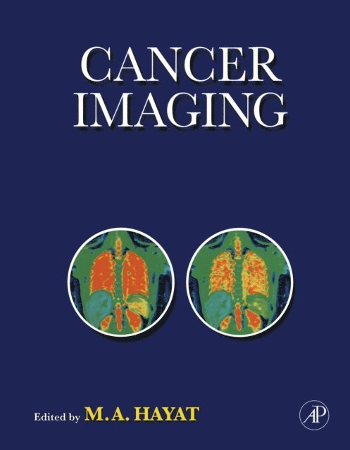 M. A. Hayat - Cancer Imaging, E-bok