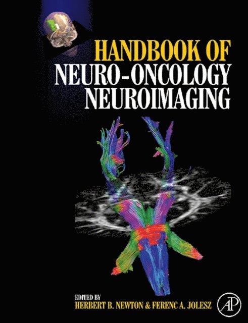 Herbert B. Newton - Handbook of Neuro-Oncology Neuroimaging, E-bok