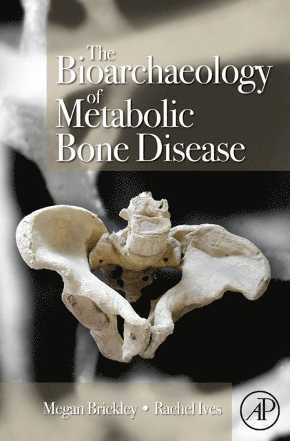 Rachel Ives, Megan B. Brickley - Bioarchaeology of Metabolic Bone Disease, E-bok