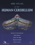 MRI Atlas of the Human Cerebellum