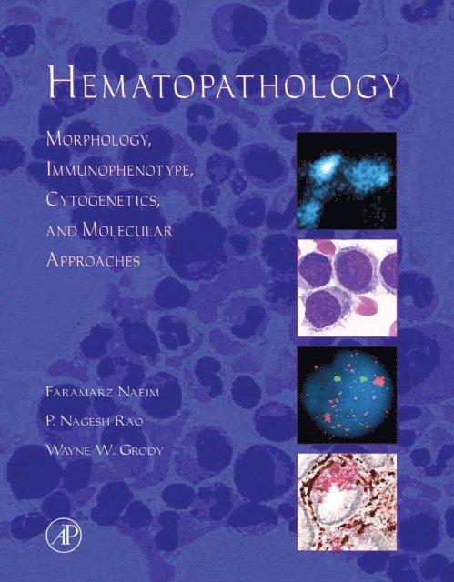 Wayne W. Grody, P. Nagesh Rao, Faramarz Naeim - Hematopathology, E-bok