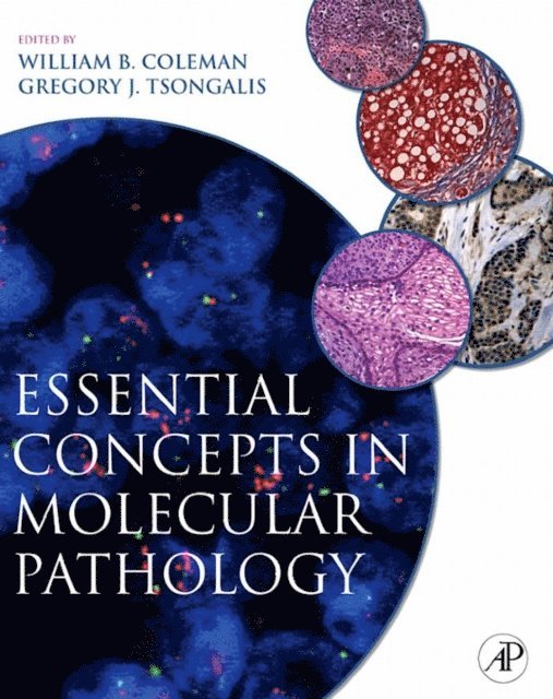Gregory J. Tsongalis, William B. Coleman - Essential Concepts in Molecular Pathology, E-bok