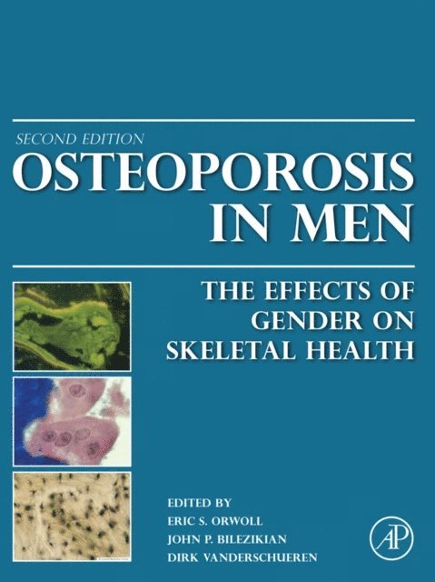 Dirk Vanderschueren, John P. Bilezikian, Eric S. Orwoll - Osteoporosis in Men, E-bok