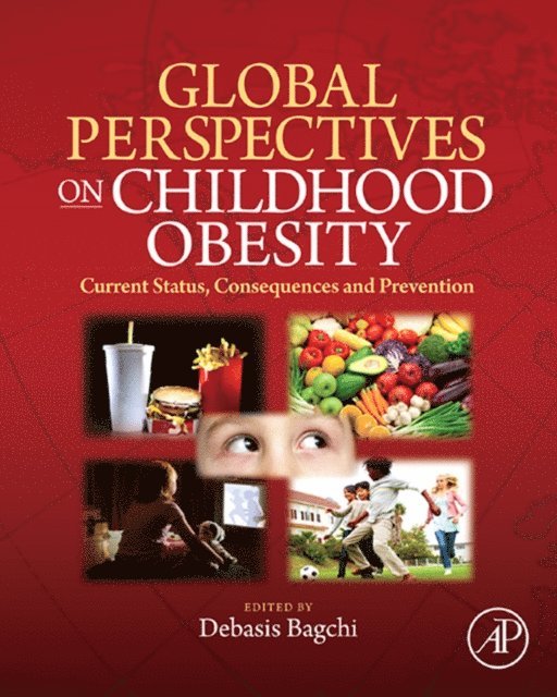 Debasis Bagchi - Global Perspectives on Childhood Obesity, E-bok