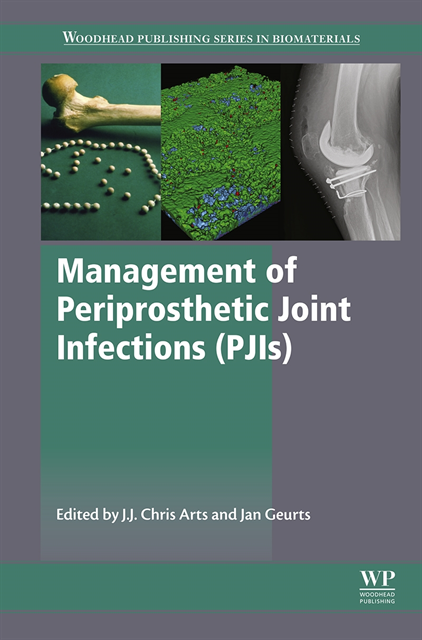 Jan Geurts, J.J. Chris Arts - Management of Periprosthetic Joint Infections (PJIs), E-bok