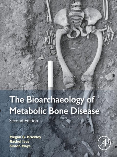 Simon Mays, Rachel Ives, Megan B. Brickley - Bioarchaeology of Metabolic Bone Disease, E-bok