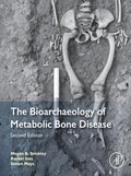 Bioarchaeology of Metabolic Bone Disease