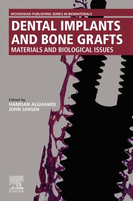 John Jansen, Hamdan Alghamdi - Dental Implants and Bone Grafts, E-bok. Tillgänglighet: Lägg i varukorg