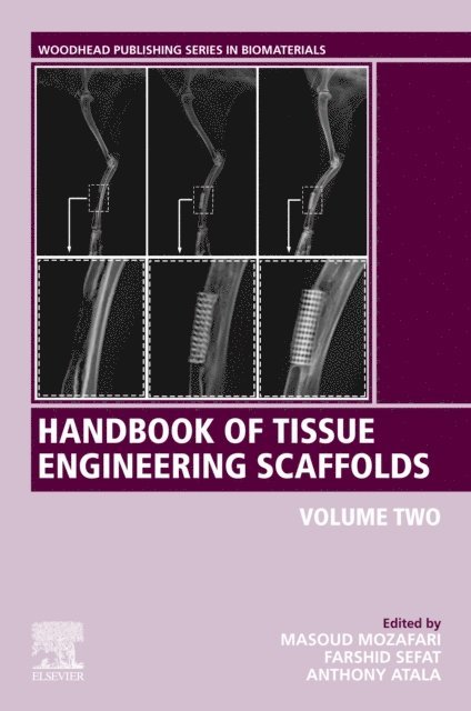 Anthony Atala, Farshid Sefat, Masoud Mozafari - Handbook of Tissue Engineering Scaffolds: Volume Two, E-bok