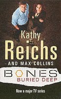 Bones