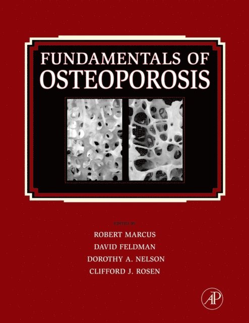 Clifford Rosen, Dorothy Nelson, David Feldman, Robert Marcus - Fundamentals of Osteoporosis, E-bok