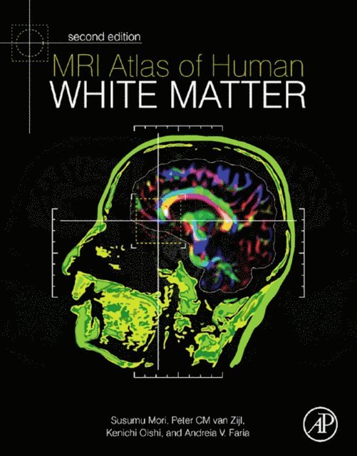 Susumu Mori, Peter C M van Zijl, Andreia V. Faria, Kenichi Oishi - MRI Atlas of Human White Matter, E-bok. Tillgänglighet: Lägg i varukorg