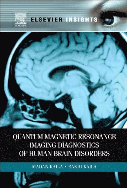 Rakhi Kaila, Madan M Kaila - Quantum Magnetic Resonance Imaging Diagnostics of Human Brain Disorders, E-bok