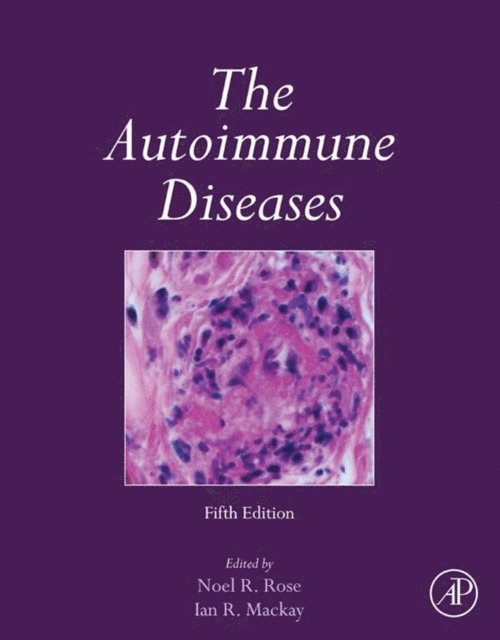 George C. Tsokos, M. Eric Gershwin - Autoimmune Diseases, E-bok