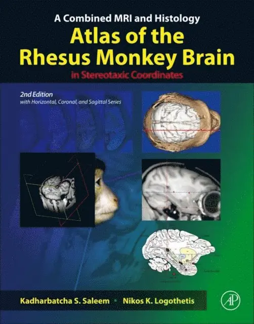 Nikos K. Logothetis, Kadharbatcha S. Saleem - Combined MRI and Histology Atlas of the Rhesus Monkey Brain in Stereotaxic Coordinates, E-bok. Tillgänglighet: Lägg i varukorg