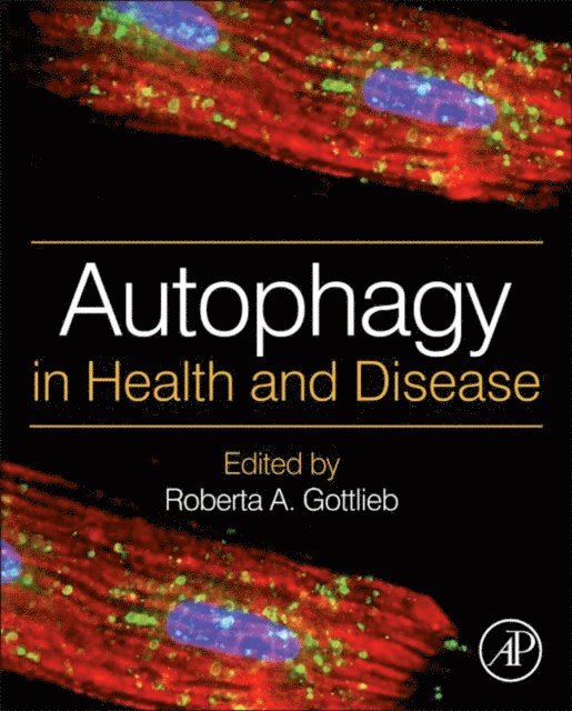 Roberta A. Gottlieb - Autophagy in Health and Disease, E-bok. Tillgänglighet: Lägg i varukorg
