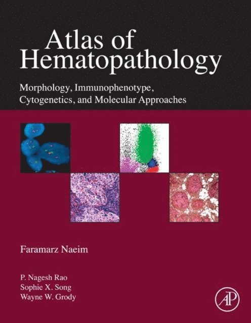 Faramarz Naeim - Atlas of Hematopathology, E-bok