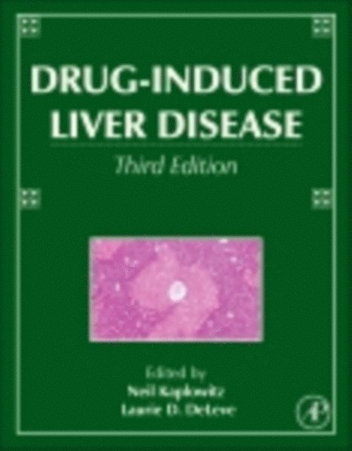 Laurie D. DeLeve, Neil Kaplowitz - Drug-Induced Liver Disease, E-bok