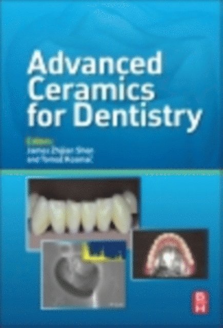 Advanced Ceramics for Dentistry