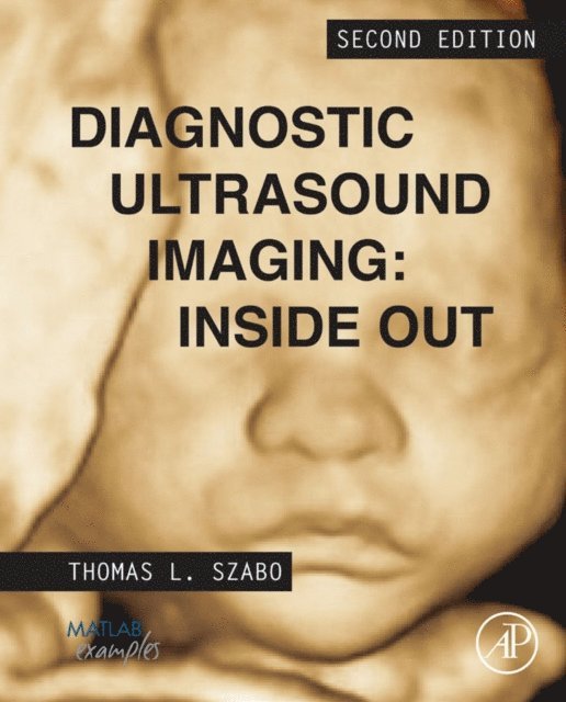 Thomas L. Szabo - Diagnostic Ultrasound Imaging: Inside Out, E-bok