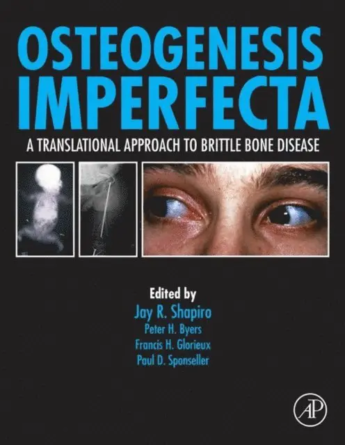 Paul Sponseller, Javaid Kassim - Osteogenesis Imperfecta, E-bok. Tillgänglighet: Lägg i varukorg