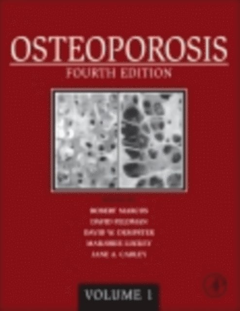 David Feldman, Jane A. Cauley, David W. Dempster, Robert Marcus - Osteoporosis, E-bok