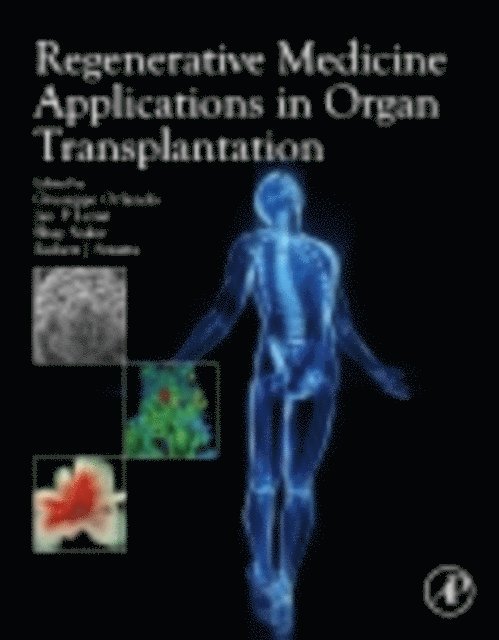 Giuseppe Orlando - Regenerative Medicine Applications in Organ Transplantation, E-bok
