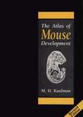 The Atlas of Mouse Development