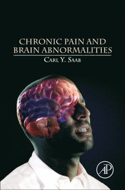 Carl Y. Saab - Chronic Pain and Brain Abnormalities, E-bok