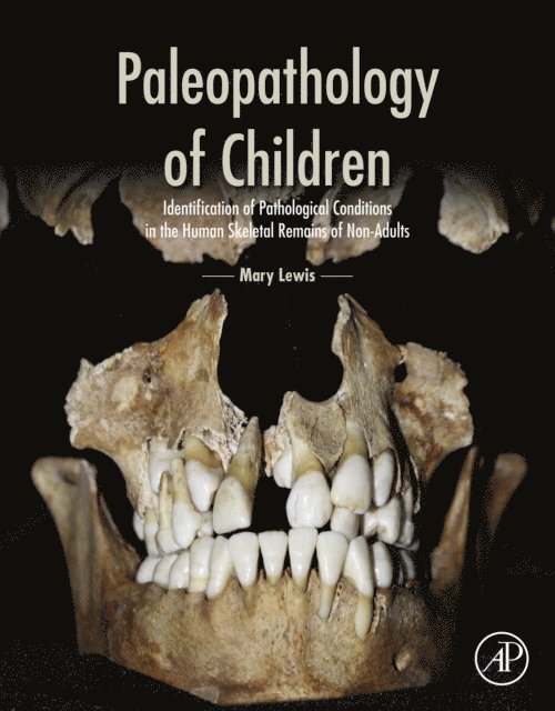 Mary Lewis - Paleopathology of Children, E-bok