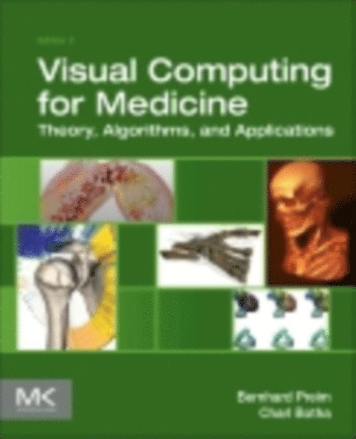 Charl P Botha, Bernhard Preim - Visual Computing for Medicine, E-bok