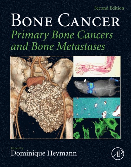 Dominique Heymann - Bone Cancer, E-bok. Tillgänglighet: Lägg i varukorg