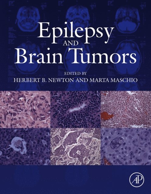Marta Maschio, Herbert B. Newton - Epilepsy and Brain Tumors, E-bok