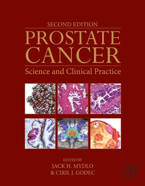 Ciril J. Godec, Jack H. Mydlo - Prostate Cancer, E-bok