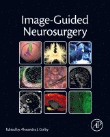 Alexandra J. Golby - Image-Guided Neurosurgery, Inbunden