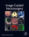 Image-Guided Neurosurgery