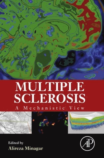 Alireza Minagar - Multiple Sclerosis, E-bok