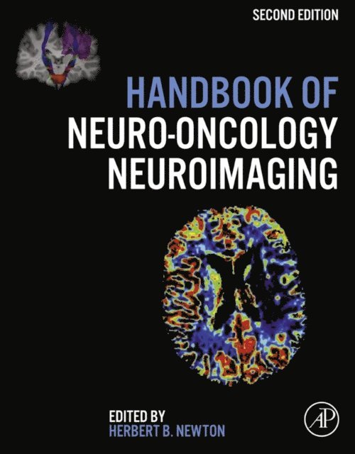 Herbert B. Newton - Handbook of Neuro-Oncology Neuroimaging, E-bok