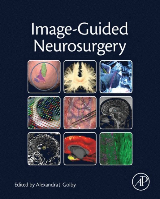 Alexandra J. Golby - Image-Guided Neurosurgery, E-bok