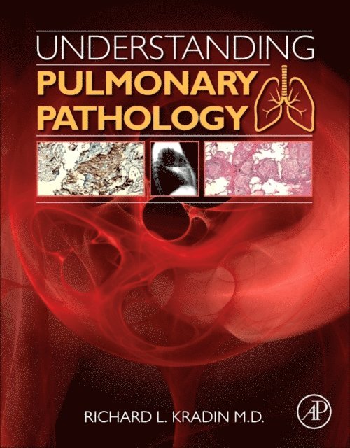 Richard L. Kradin - Understanding Pulmonary Pathology, E-bok