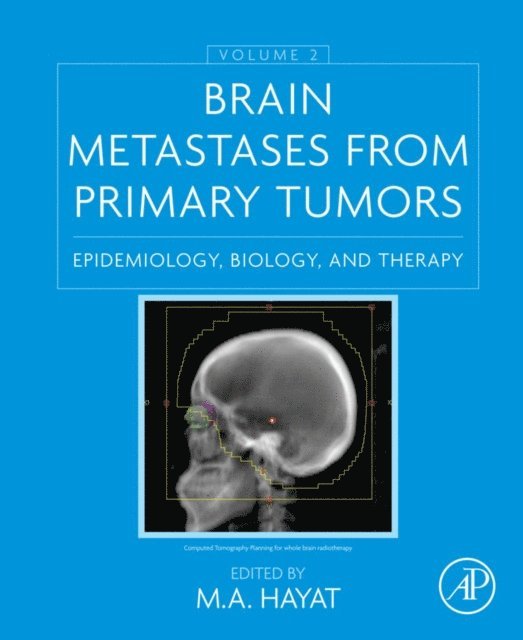 M. A. Hayat - Brain Metastases from Primary Tumors, Volume 2, E-bok