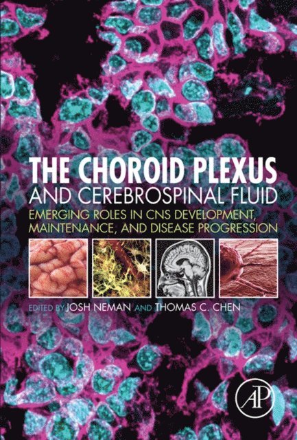 Thomas C. Chen, Josh Neman - Choroid Plexus and Cerebrospinal Fluid, E-bok