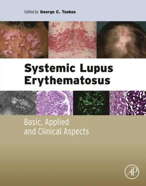 George C. Tsokos - Systemic Lupus Erythematosus, E-bok